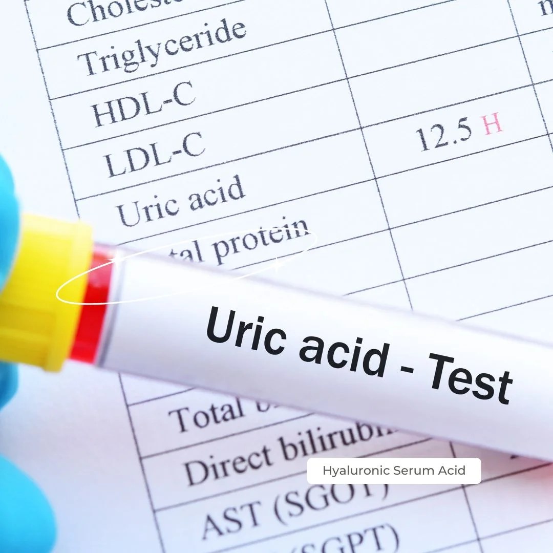 High Uric Acid Diet