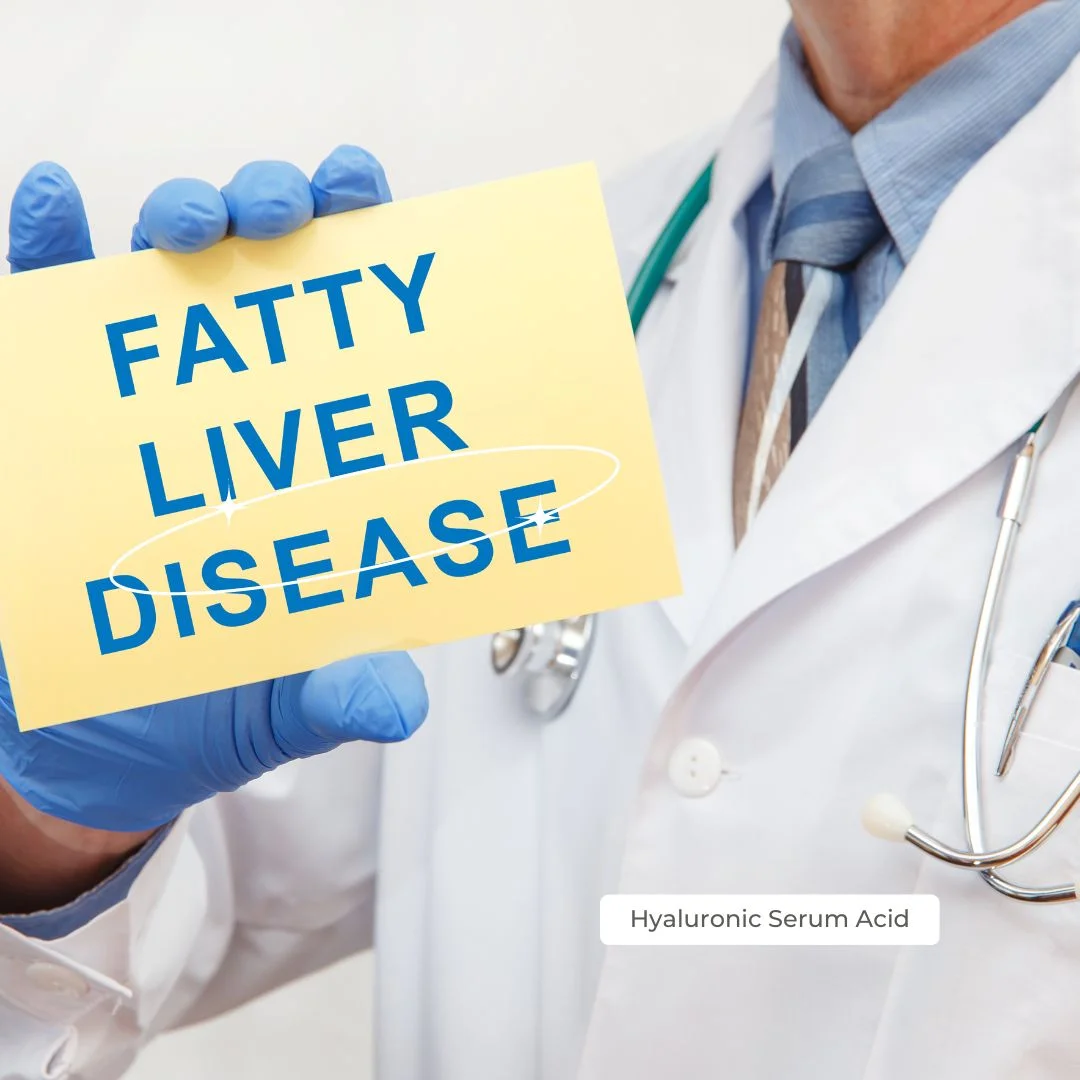 Fatty Liver